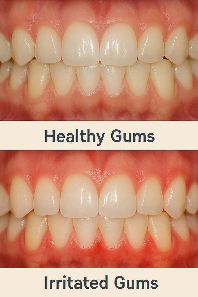 Other gum health issues